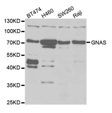 Western blot - GNAS Antibody from Signalway Antibody (32899) - Antibodies.com