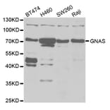 Western blot - GNAS Antibody from Signalway Antibody (32899) - Antibodies.com