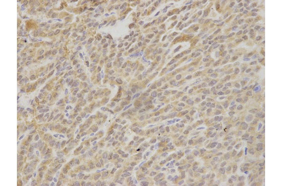 Immunohistochemistry - HAX1 Antibody from Signalway Antibody (32902) - Antibodies.com
