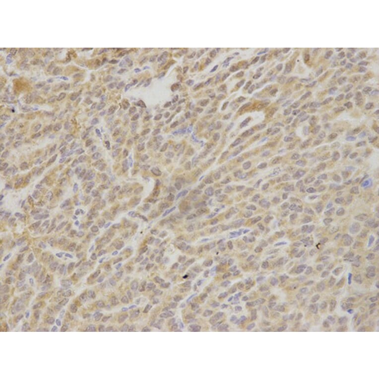Immunohistochemistry - HAX1 Antibody from Signalway Antibody (32902) - Antibodies.com