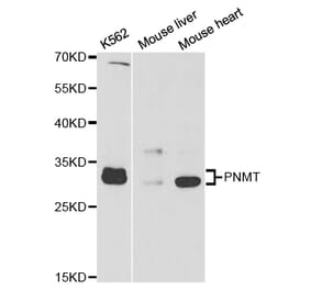 Western blot - PNMT Antibody from Signalway Antibody (32904) - Antibodies.com