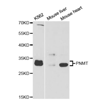 Western blot - PNMT Antibody from Signalway Antibody (32904) - Antibodies.com
