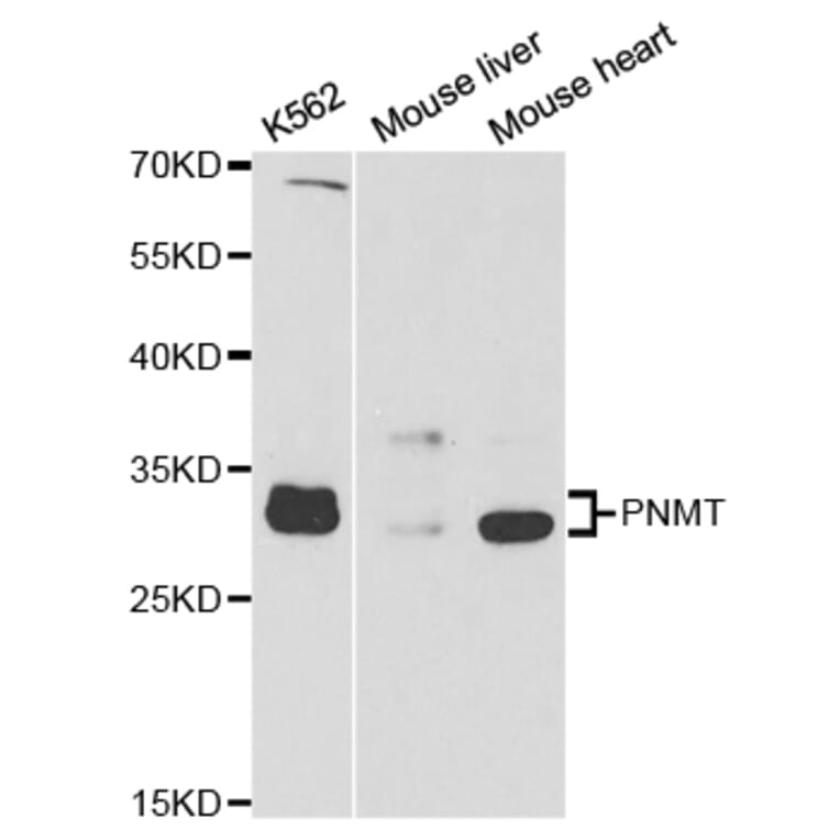 Western blot - PNMT Antibody from Signalway Antibody (32904) - Antibodies.com