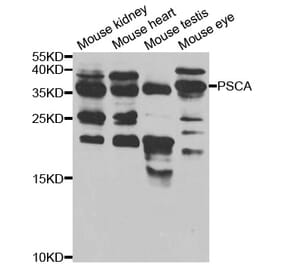 Western blot - PSCA Antibody from Signalway Antibody (32922) - Antibodies.com