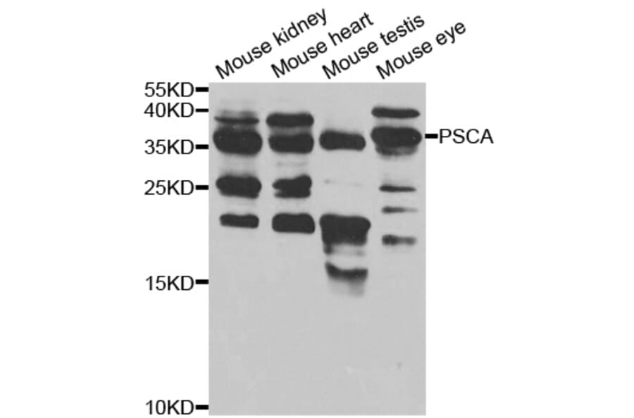 Western blot - PSCA Antibody from Signalway Antibody (32922) - Antibodies.com