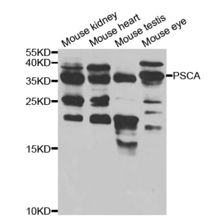 Western blot - PSCA Antibody from Signalway Antibody (32922) - Antibodies.com