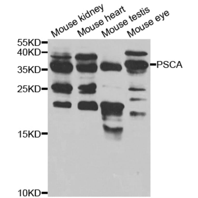 Western blot - PSCA Antibody from Signalway Antibody (32922) - Antibodies.com