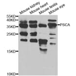 Western blot - PSCA Antibody from Signalway Antibody (32922) - Antibodies.com