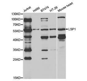 Western blot - LSP1 Antibody from Signalway Antibody (32925) - Antibodies.com