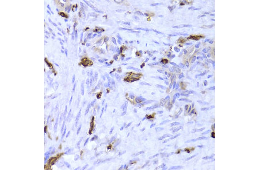 Immunohistochemistry - LSP1 Antibody from Signalway Antibody (32925) - Antibodies.com
