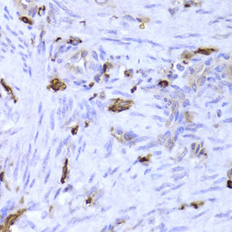 Immunohistochemistry - LSP1 Antibody from Signalway Antibody (32925) - Antibodies.com