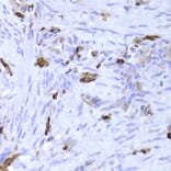 Immunohistochemistry - LSP1 Antibody from Signalway Antibody (32925) - Antibodies.com