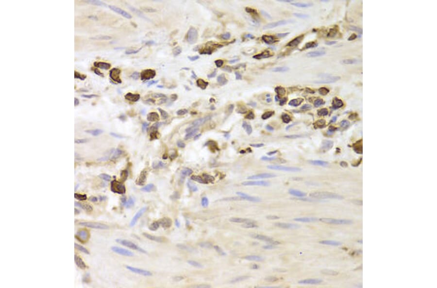 Immunohistochemistry - LSP1 Antibody from Signalway Antibody (32925) - Antibodies.com