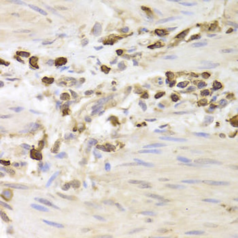 Immunohistochemistry - LSP1 Antibody from Signalway Antibody (32925) - Antibodies.com