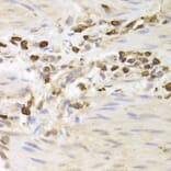 Immunohistochemistry - LSP1 Antibody from Signalway Antibody (32925) - Antibodies.com