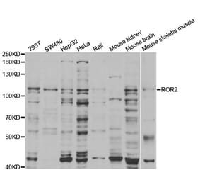 Western blot - ROR2 Antibody from Signalway Antibody (32928) - Antibodies.com