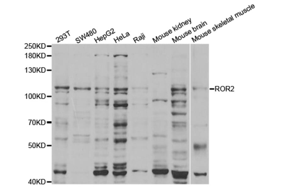Western blot - ROR2 Antibody from Signalway Antibody (32928) - Antibodies.com