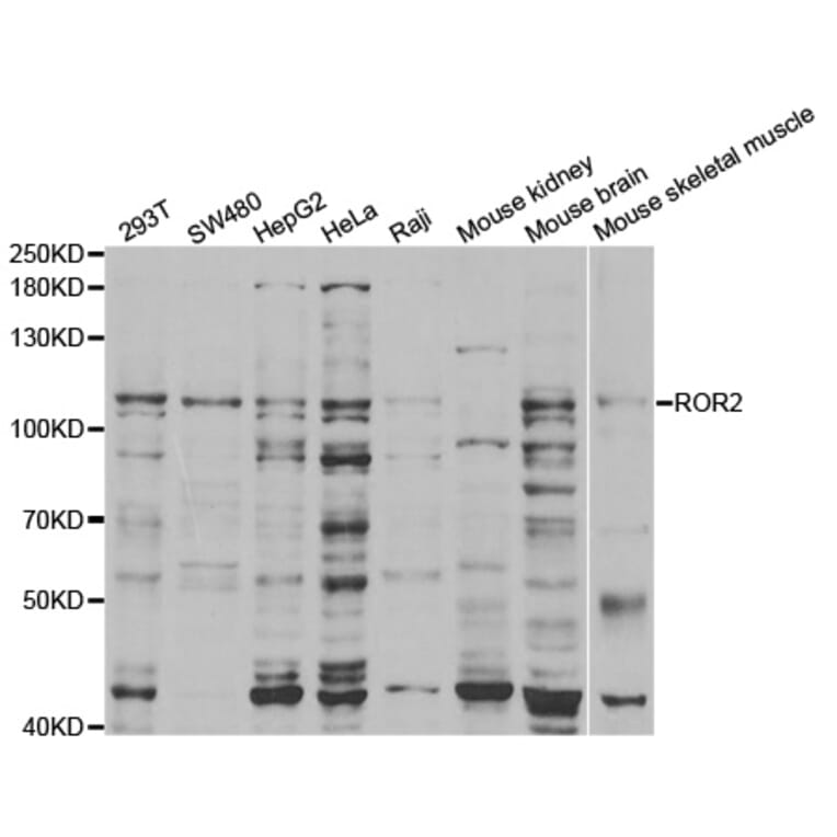 Western blot - ROR2 Antibody from Signalway Antibody (32928) - Antibodies.com