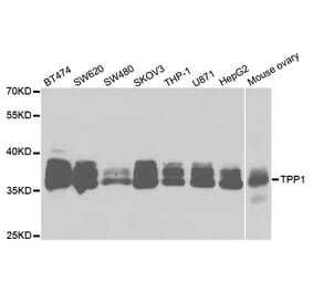 Western blot - TPP1 Antibody from Signalway Antibody (32932) - Antibodies.com