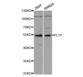 Western blot - PLTP Antibody from Signalway Antibody (32933) - Antibodies.com