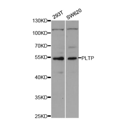 Western blot - PLTP Antibody from Signalway Antibody (32933) - Antibodies.com