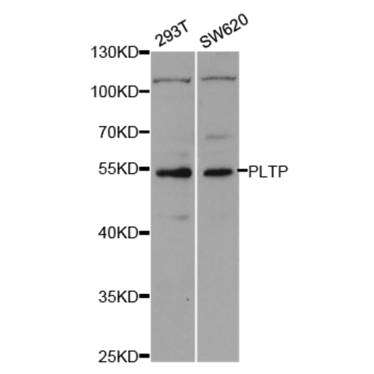 Western blot - PLTP Antibody from Signalway Antibody (32933) - Antibodies.com