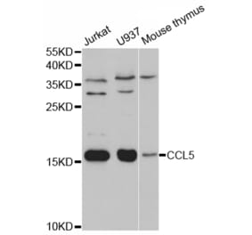 Western blot - CCL5 Antibody from Signalway Antibody (32935) - Antibodies.com