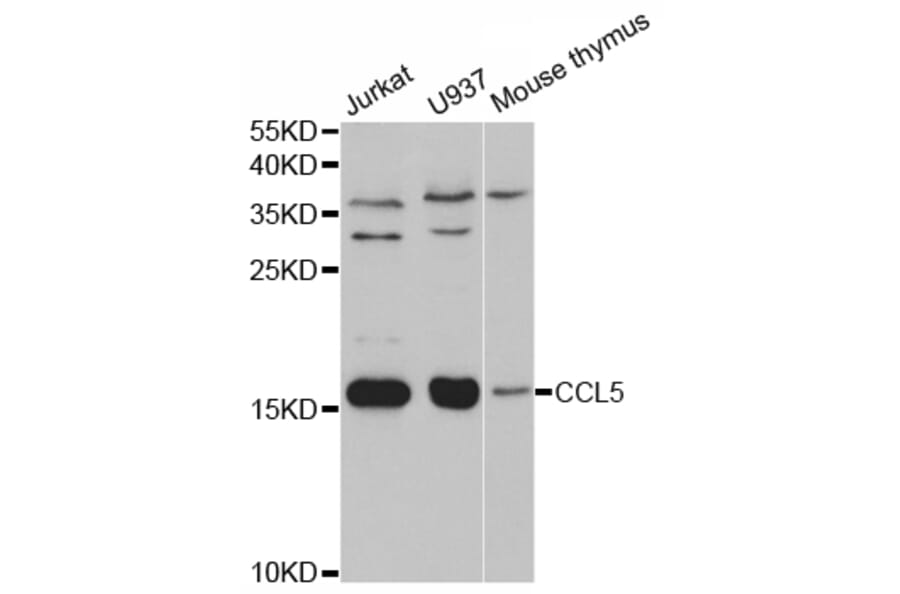 Western blot - CCL5 Antibody from Signalway Antibody (32935) - Antibodies.com
