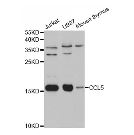 Western blot - CCL5 Antibody from Signalway Antibody (32935) - Antibodies.com