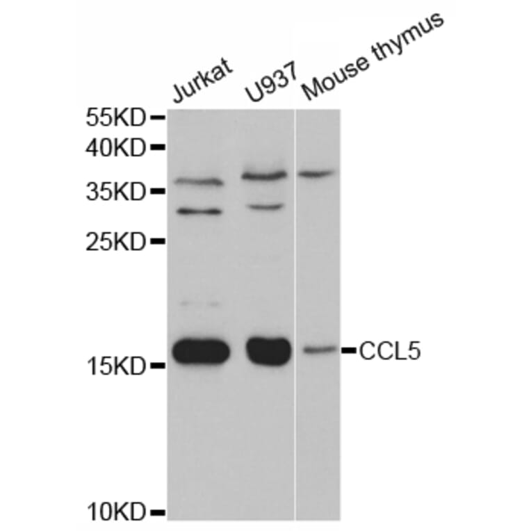 Western blot - CCL5 Antibody from Signalway Antibody (32935) - Antibodies.com