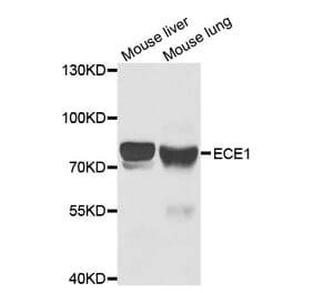 Western blot - ECE1 Antibody from Signalway Antibody (32939) - Antibodies.com