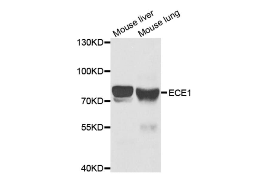 Western blot - ECE1 Antibody from Signalway Antibody (32939) - Antibodies.com