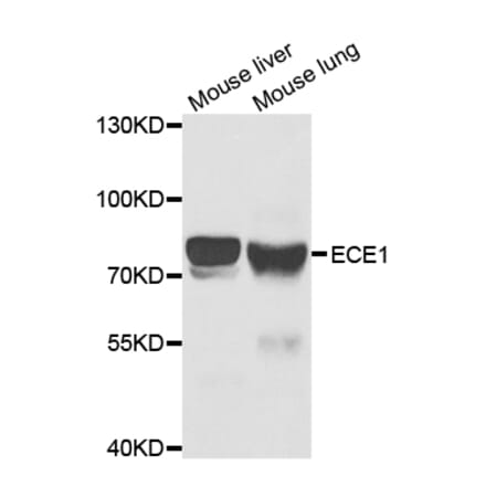 Western blot - ECE1 Antibody from Signalway Antibody (32939) - Antibodies.com