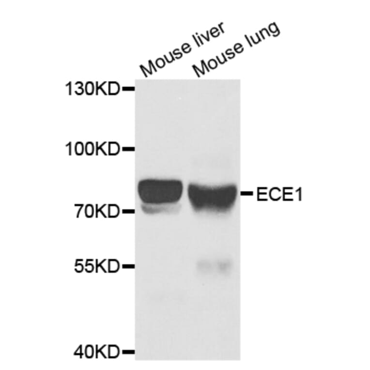 Western blot - ECE1 Antibody from Signalway Antibody (32939) - Antibodies.com