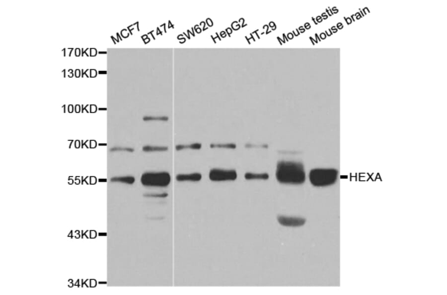 Western blot - HEXA Antibody from Signalway Antibody (32945) - Antibodies.com