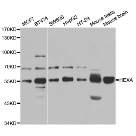 Western blot - HEXA Antibody from Signalway Antibody (32945) - Antibodies.com