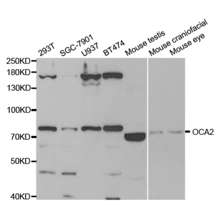 Western blot - OCA2 Antibody from Signalway Antibody (32950) - Antibodies.com