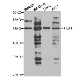 Western blot - PLAT Antibody from Signalway Antibody (32952) - Antibodies.com