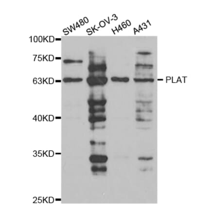 Western blot - PLAT Antibody from Signalway Antibody (32952) - Antibodies.com