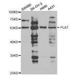 Western blot - PLAT Antibody from Signalway Antibody (32952) - Antibodies.com