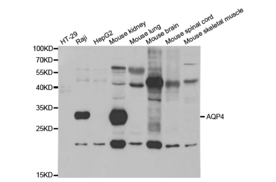 Western blot - AQP4 Antibody from Signalway Antibody (32960) - Antibodies.com