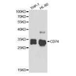 Western blot - CD74 Antibody from Signalway Antibody (32962) - Antibodies.com