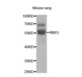 Western blot - RBPJ Antibody from Signalway Antibody (32967) - Antibodies.com