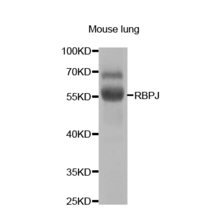 Western blot - RBPJ Antibody from Signalway Antibody (32967) - Antibodies.com