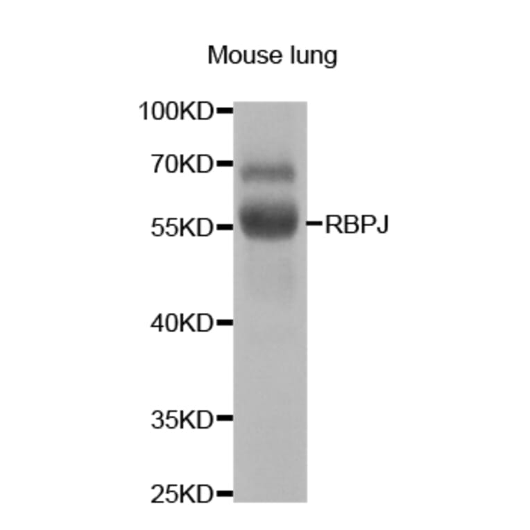 Western blot - RBPJ Antibody from Signalway Antibody (32967) - Antibodies.com