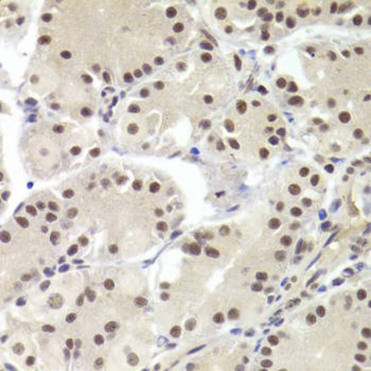 Immunohistochemistry - RBPJ Antibody from Signalway Antibody (32967) - Antibodies.com