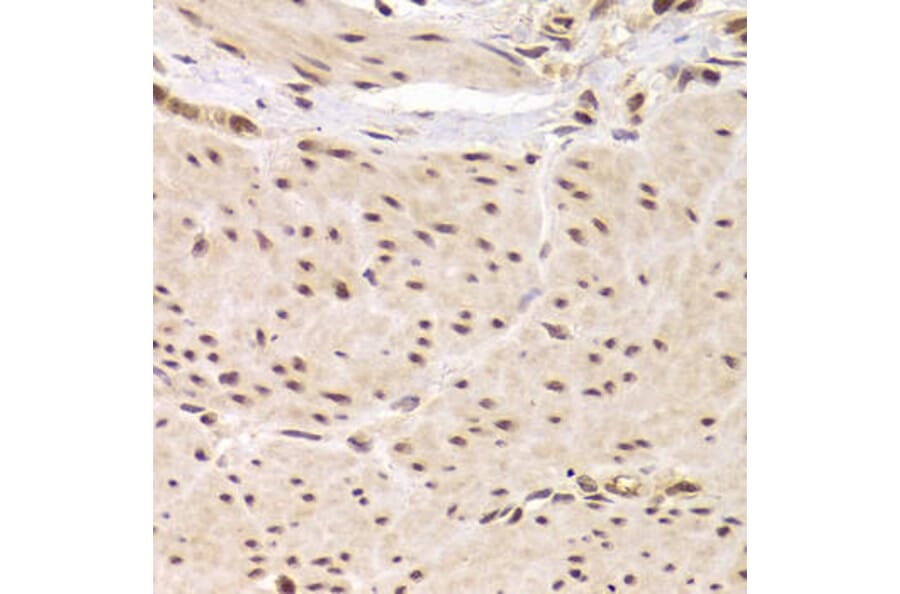 Immunohistochemistry - RBPJ Antibody from Signalway Antibody (32967) - Antibodies.com