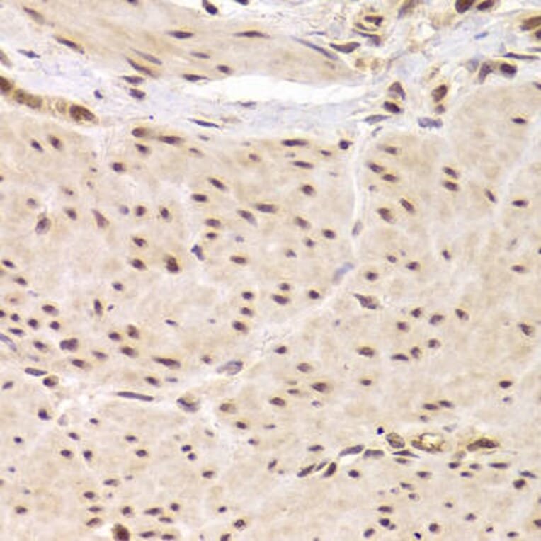 Immunohistochemistry - RBPJ Antibody from Signalway Antibody (32967) - Antibodies.com