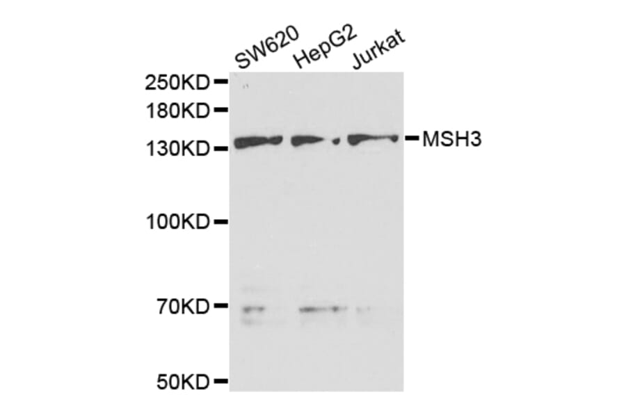 Western blot - MSH3 Antibody from Signalway Antibody (32971) - Antibodies.com