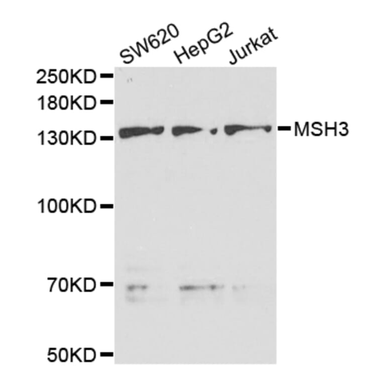 Western blot - MSH3 Antibody from Signalway Antibody (32971) - Antibodies.com